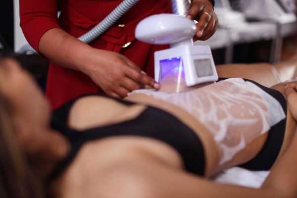 Get Your Dream Body with Non-Invasive Fat Freezing Chelsea