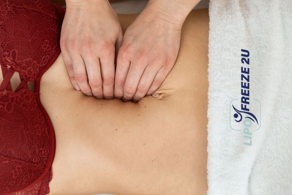 diastasis recti treatment Chelsea