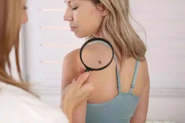 A side-by-side infographic comparing CryoPen cryotherapy with electrosurgery, highlighting differences in invasiveness, pain, and recovery Chelsea