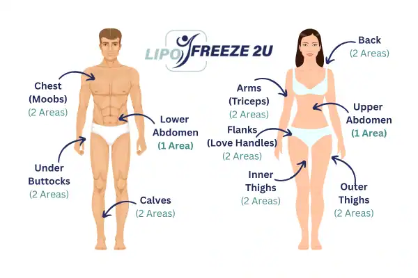 Areas you can have fat freezing treatment Chelsea