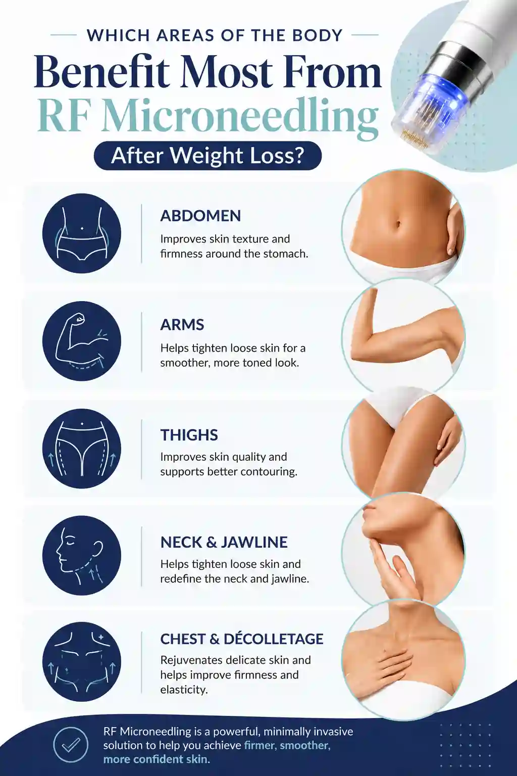 Which Areas of the Body Benefit Most From RF Microneedling After Weight Loss Chelsea
